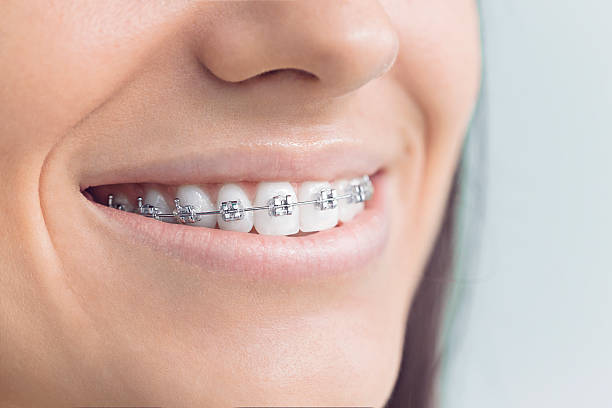 Best Sedation Dentistry  in Carencro, LA